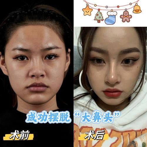 乐清柳台医院整形美容科预约挂号方式