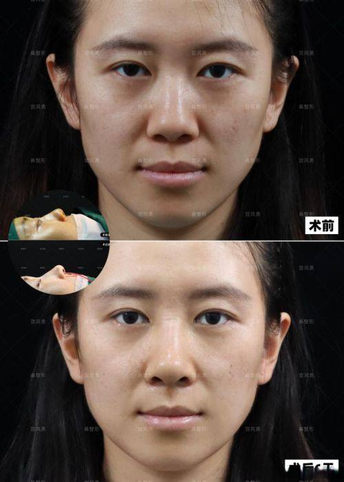 厦门174医院烧伤整形科口碑评价