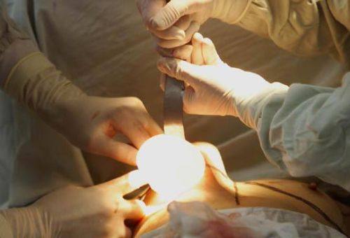 惠州惠阳丽港医疗美容门诊部医生名单及擅长领域：