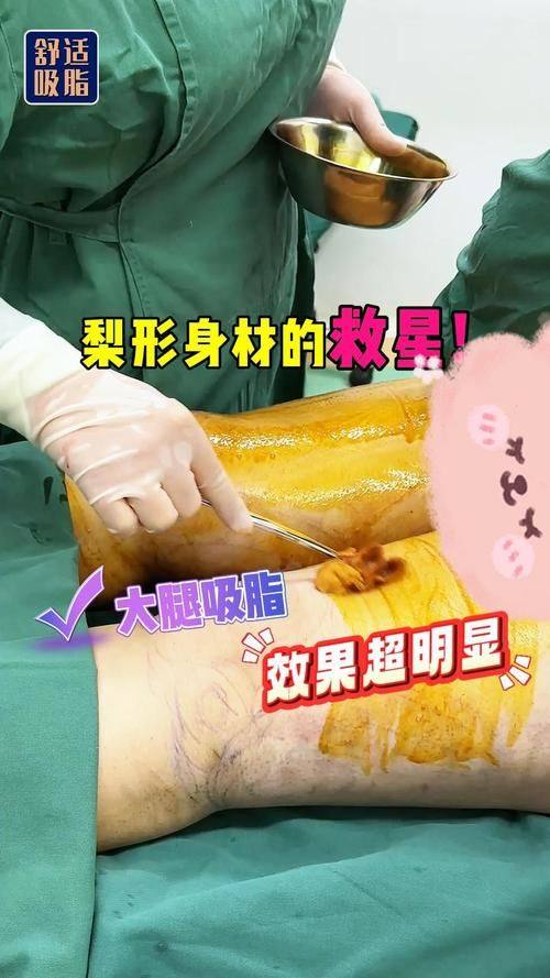 惠州惠阳丽港医疗美容门诊部擅长项目：