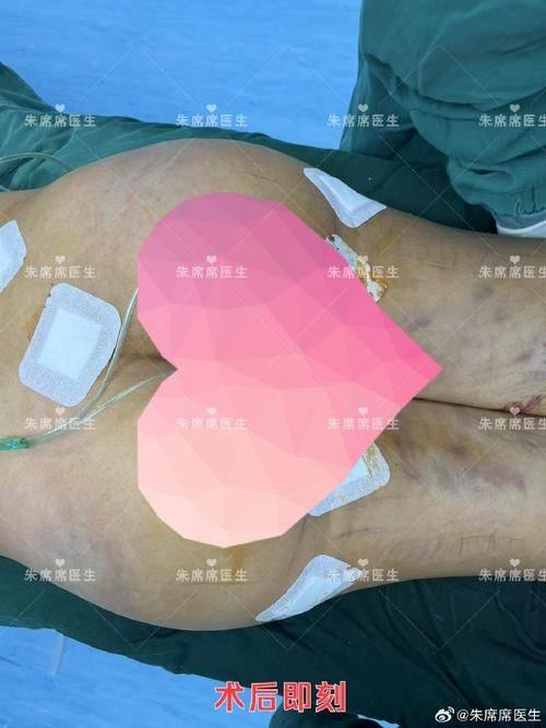 惠州惠阳丽港医疗美容门诊部地址电话及营业时间