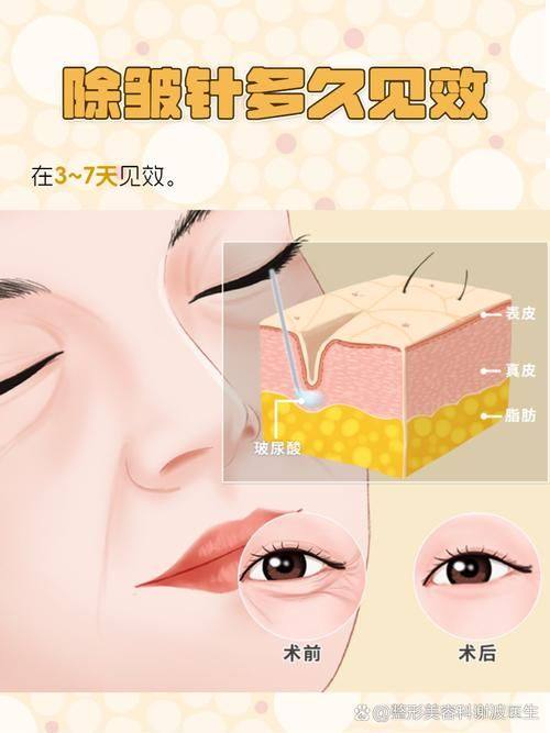 郑州洪波整形美容医院擅长项目: