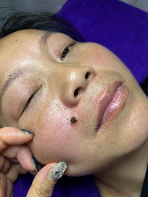 湖南康雅医院烧伤整形科价格表：