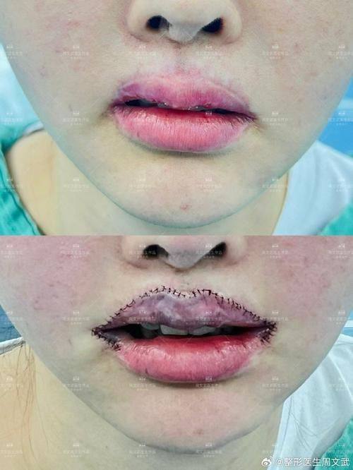 山西省儿童医院整形科口碑评价