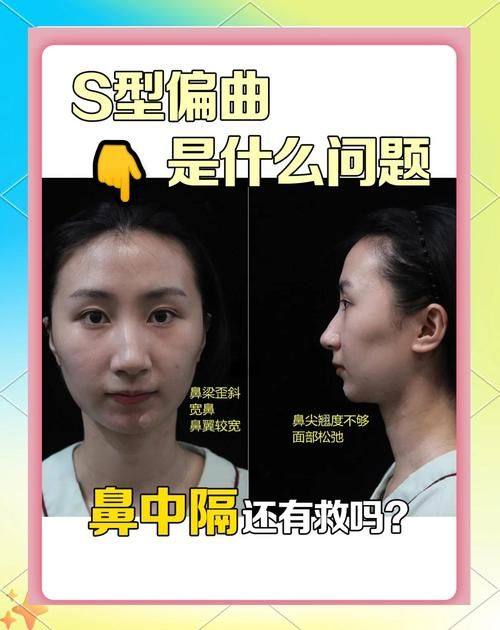 湖南康雅医院烧伤整形科口碑评价：