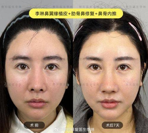 湖南康雅医院烧伤整形科怎么样？