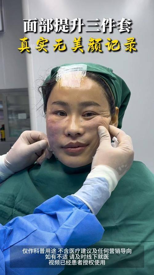 乐清柳台医院整形美容科怎么样?