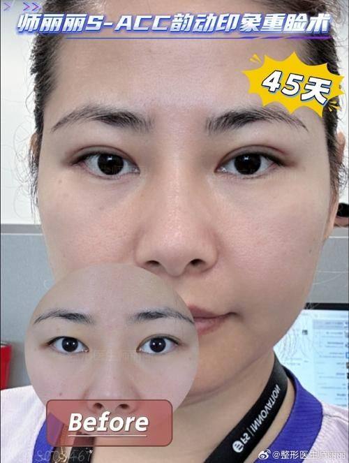 山西省儿童医院整形科地址电话及营业时间