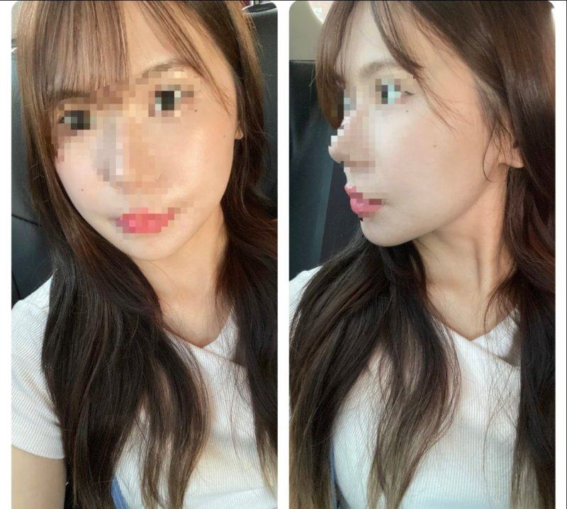 二、疤痕变深的日常护理小妙招