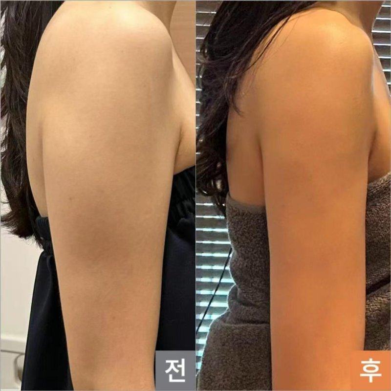 合肥包河区疾病防控中 心价格表