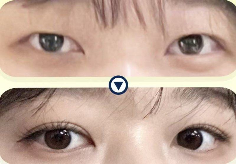 郑州洪波整形美容医院价格表: