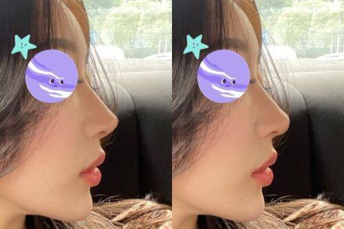 上海医颜医疗美容价格表：