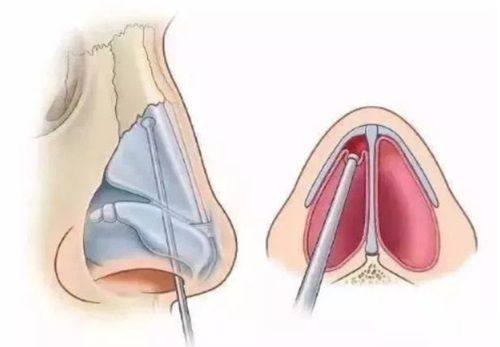 潘延平医生口碑评价