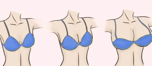 六、手术注意事项