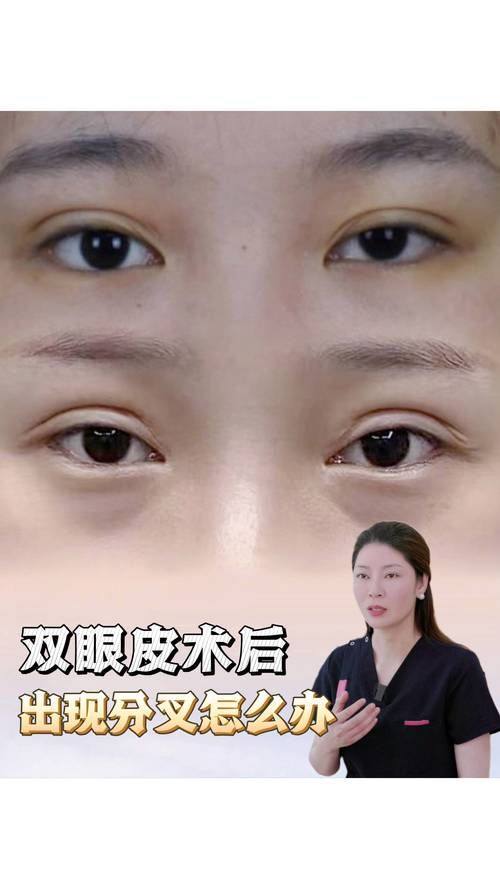 长春市益美医疗美容价格表：