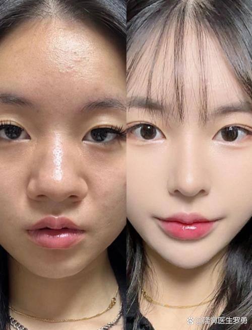 长春市益美医疗美容擅长项目：