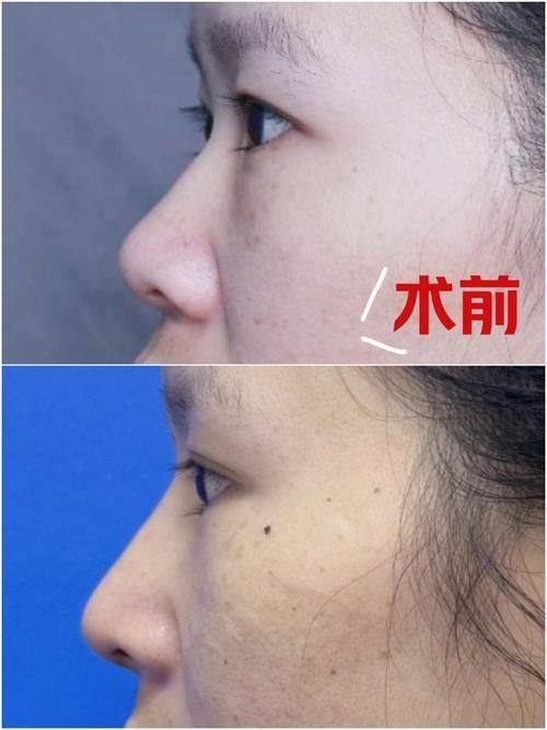 乌鲁木齐整形医院预约挂号方式