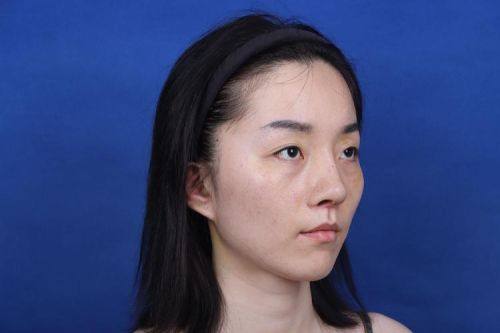 上海医颜医疗美容怎么样？