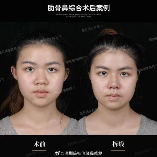 张家港澳洋唯恩整形医院怎么样？