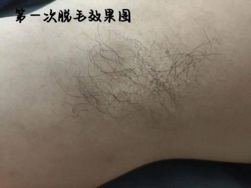 江西红苹果医疗美容门诊部口碑评价：