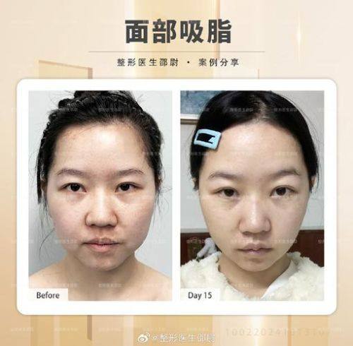 乌鲁木齐整形医院地址电话及营业时间