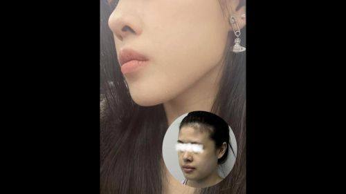 乌鲁木齐整形医院擅长项目