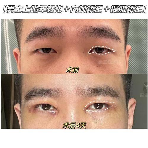 杨明勇医生技术优势：