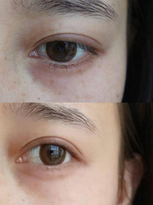 潘延平医生擅长领域