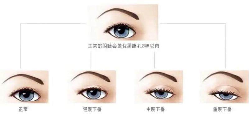 广州中家医家庭医生医疗美容门诊部聂云飞正颌手术价格及诊疗特色