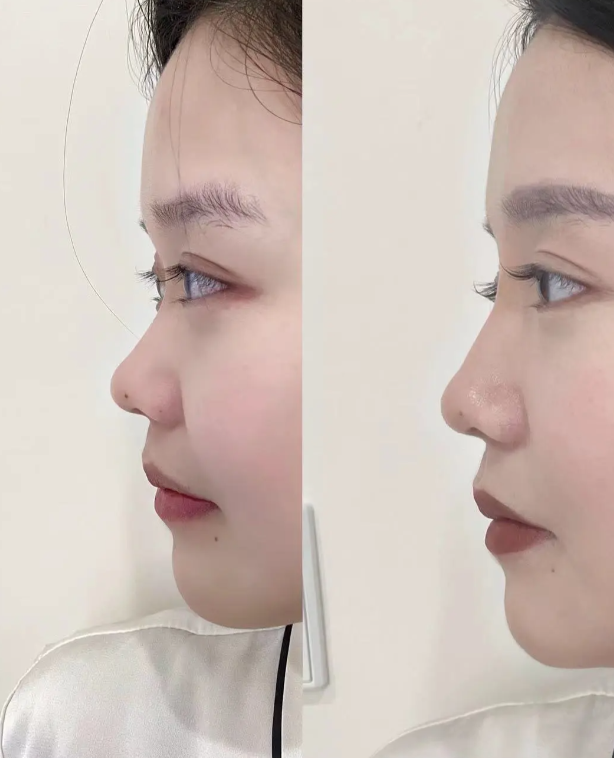 张家港澳洋唯恩整形医院预约挂号方式：