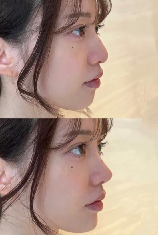 江西红苹果医疗美容门诊部价格表：