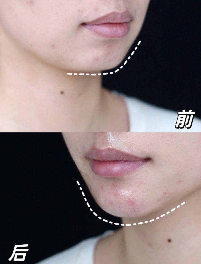 江西红苹果医疗美容门诊部地址电话及营业时间：