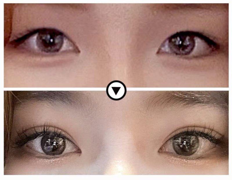 北京美人鱼医疗美容门诊部口碑评价：