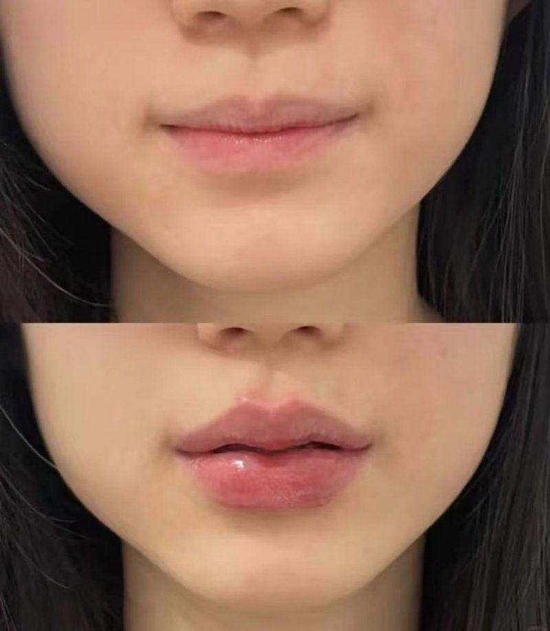 四、纹眉术后的核心护理禁忌