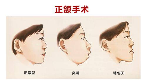 武汉米兰整形医院价格表：