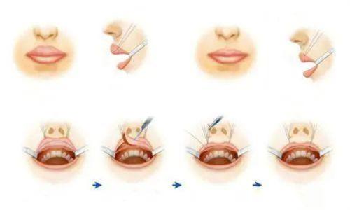 昆明涵美医疗美容诊所擅长项目