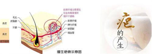 五、修复期专属注意事项