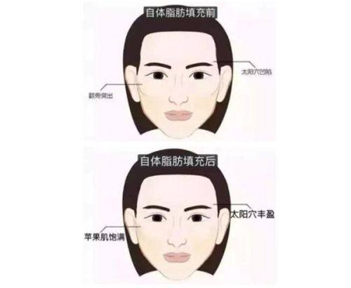 六、日常护理：淡化疤痕的长期关键