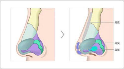 二、土豆去眼袋的成效到底好不好？