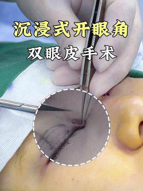 武汉美邺整形医院擅长项目：