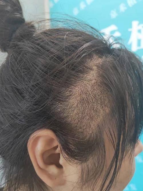 长沙时光整形医疗美容门诊部医生名单及擅长领域：