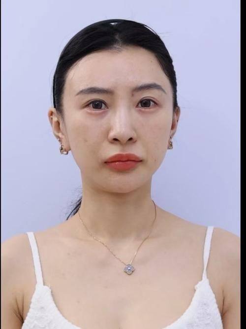 陈凌燕医生技术优势：