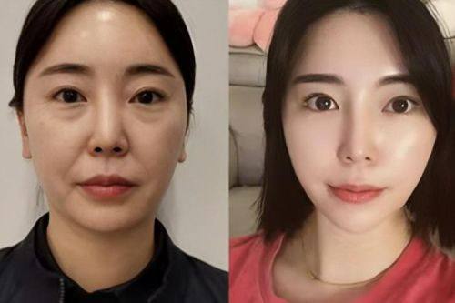 武汉米兰整形医院擅长项目：