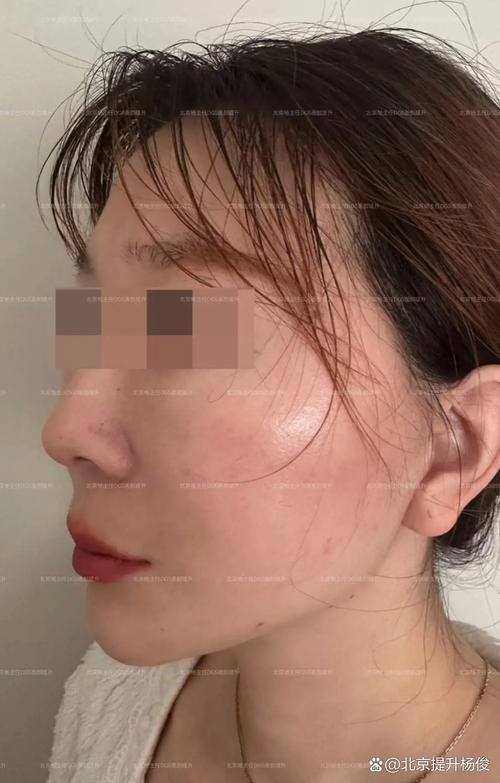 长沙时光整形医疗美容门诊部价格表：