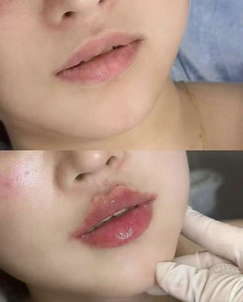 五、避免陷入土豆去眼袋的认知误区