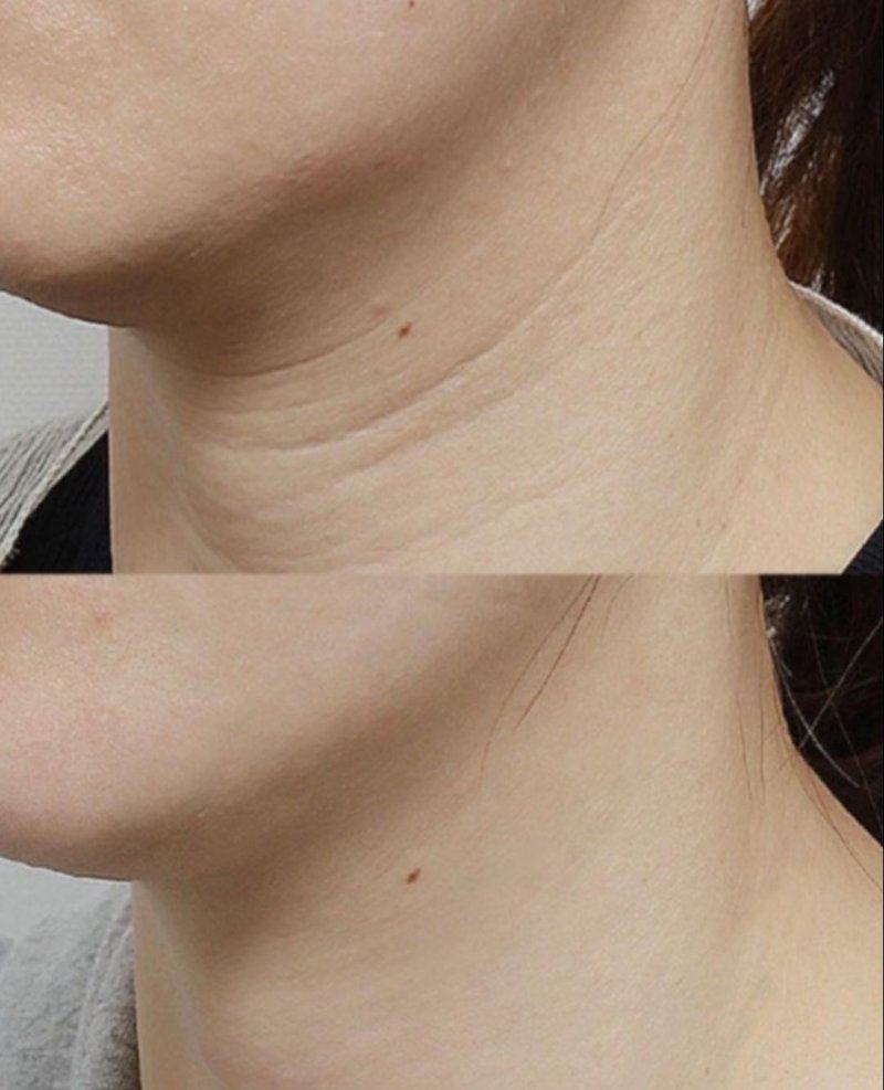 五、指甲抓伤疤痕修复药膏：居家护理的核心选择