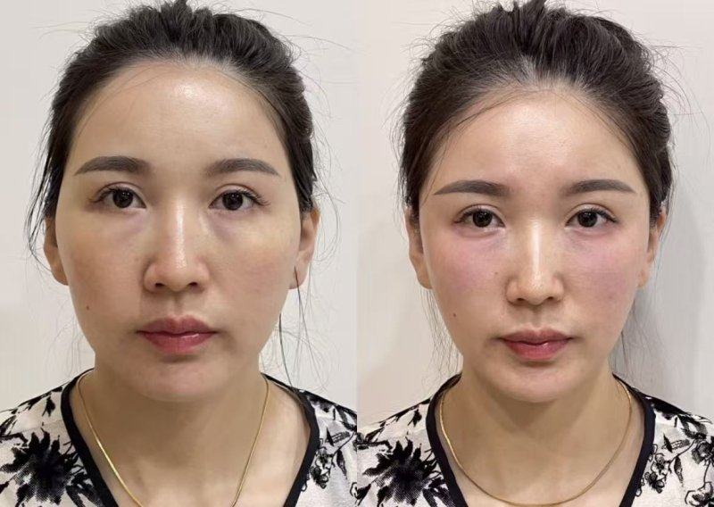 武汉米兰整形医院口碑评价：