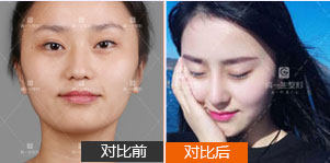 库勒(德国)医生怎么预约