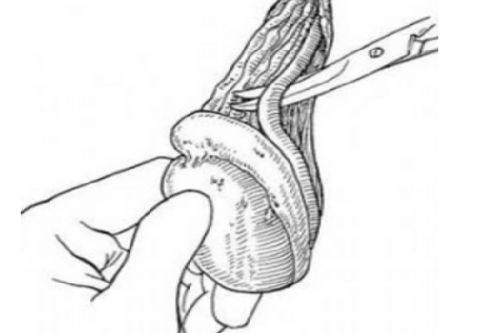 五、瘦脸针与纹眉联合术后的护理要点