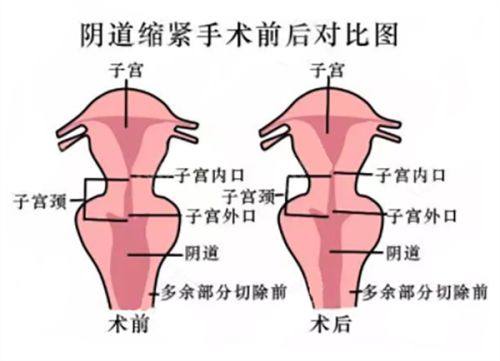 四、纹眉术前的关键准备事项